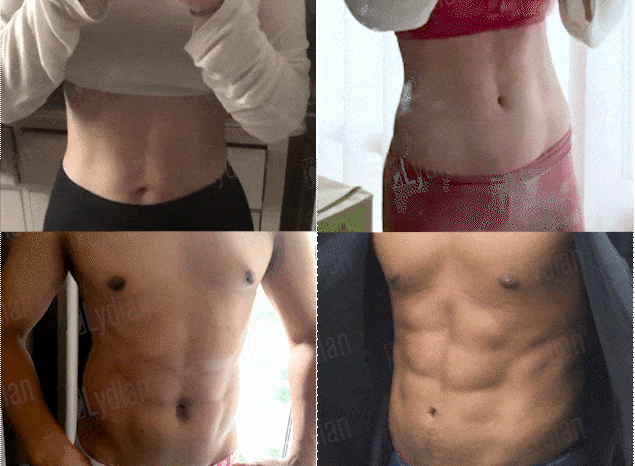 liposuction-korea