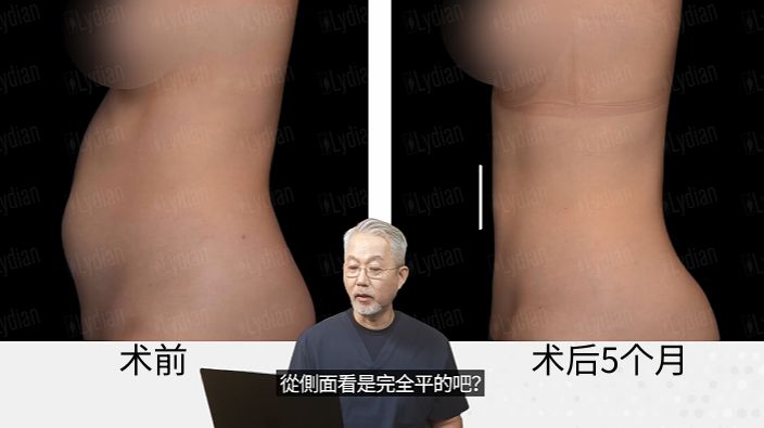 案例一配图