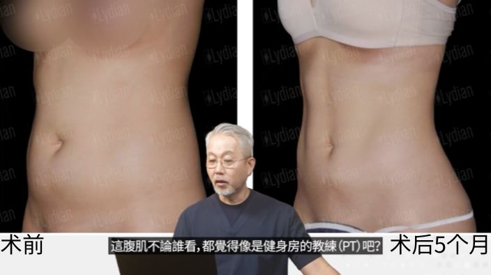 案例二配图