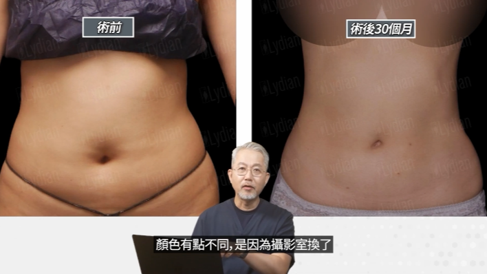 案例四配图