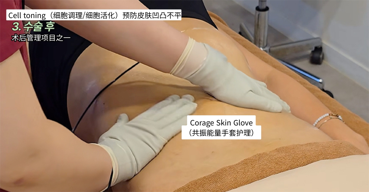0-8週消腫修復管理