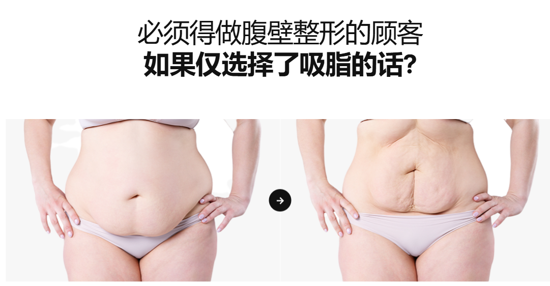 单纯抽脂带来的隐患