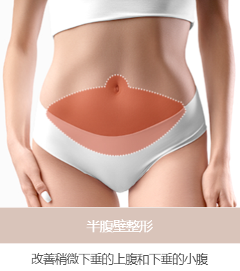 半腹壁整形术